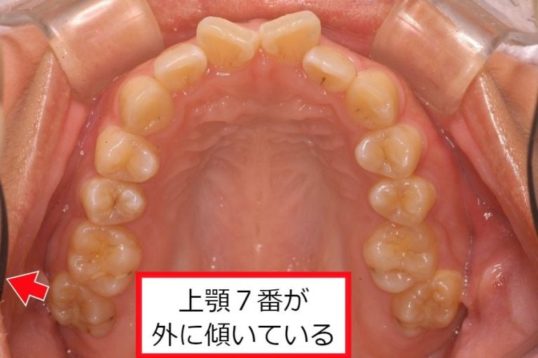 傾きの意味